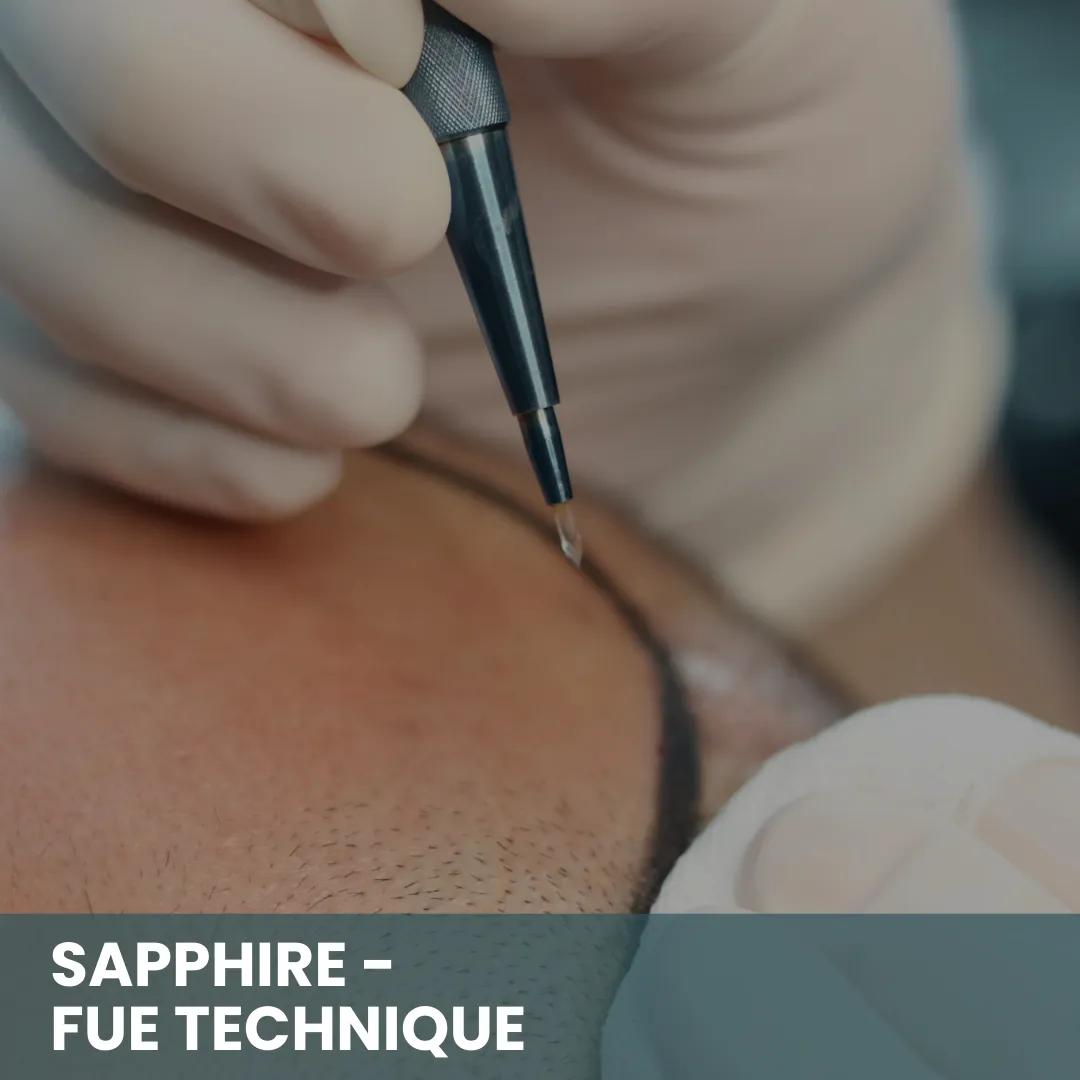 Sapphire Fue Technique