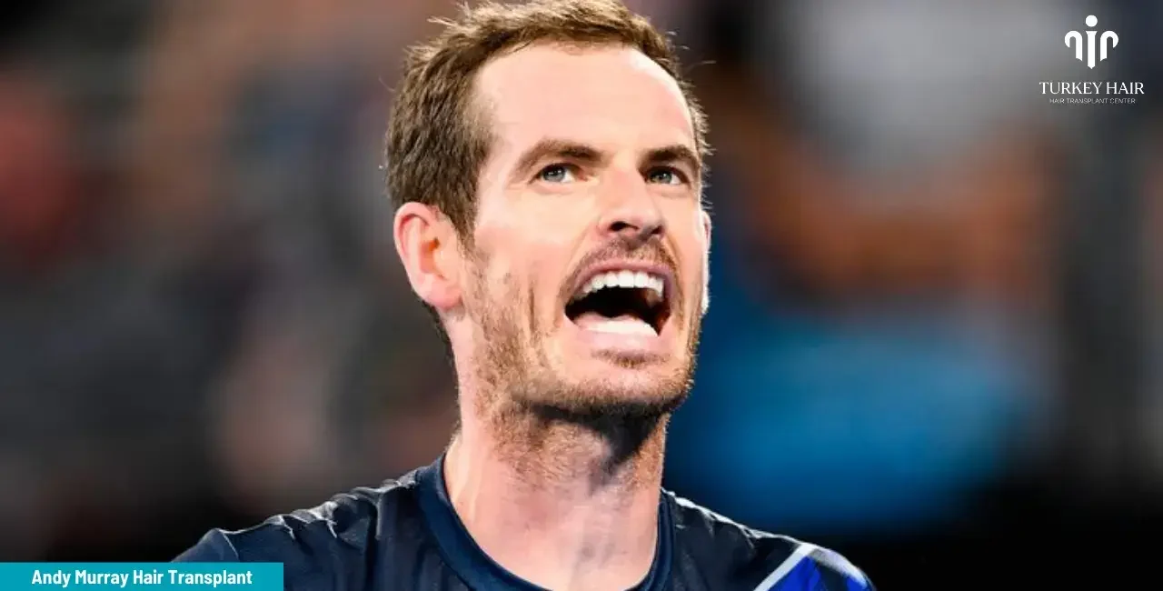 Andy Murray's hair transplant