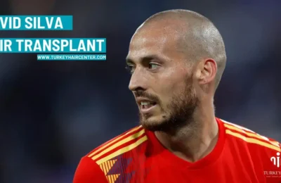David Silva Hair Transplant in Turkey Hair Transplant