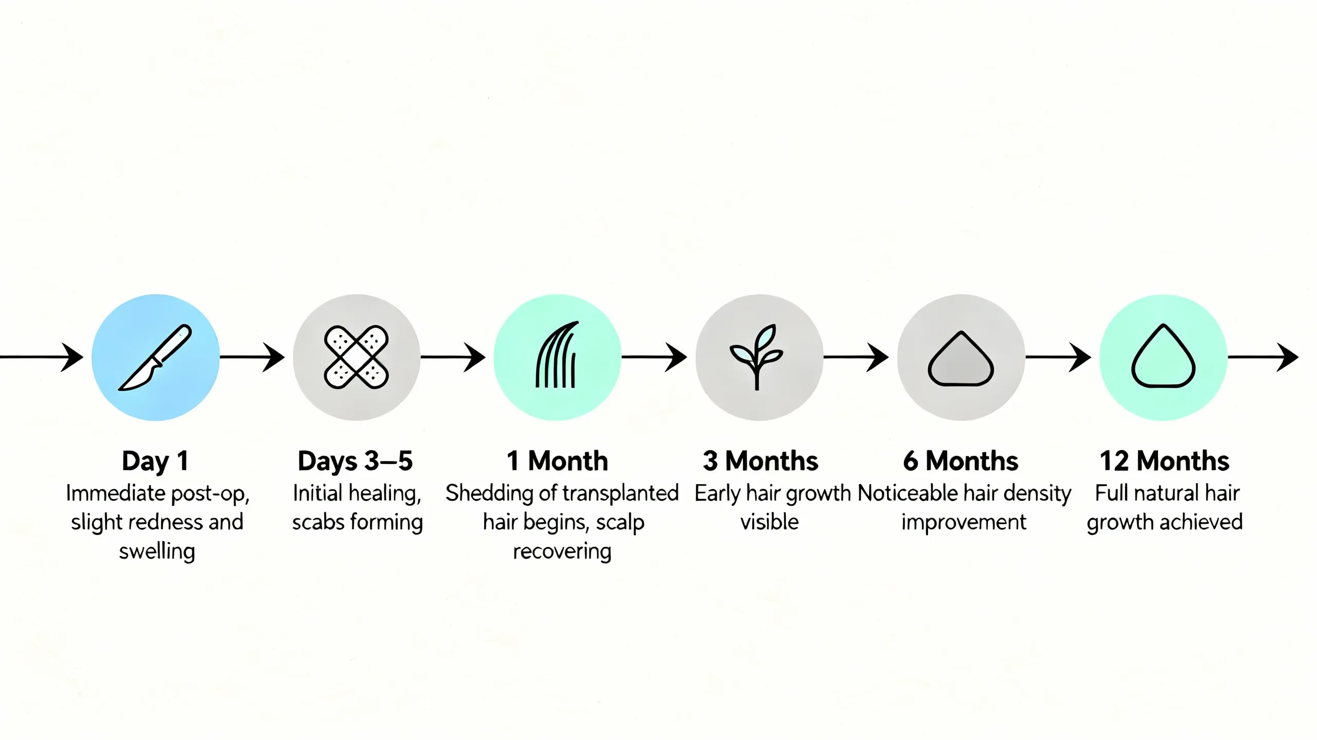 Hair Transplant Cost In Turkey Is Lower Hair Transplant Cost In Turkey Is Lower