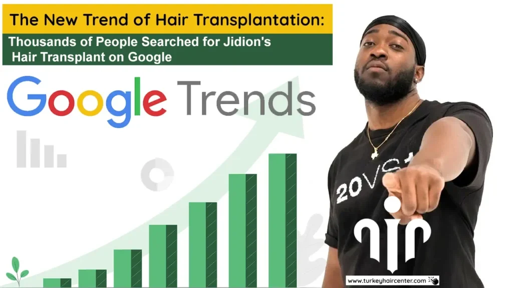 Thousands of People Searched for Jidions Hair Transplant on Google 2 1024x576 1
