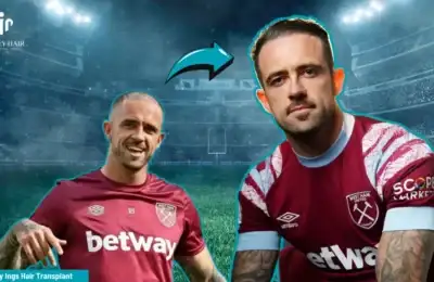 Danny Ings' Hair Transplant