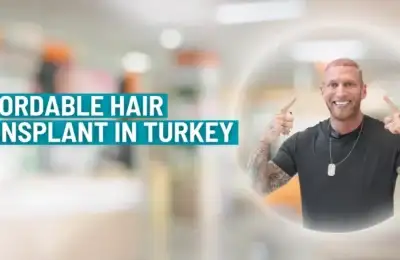 Affordable Hair Transplant