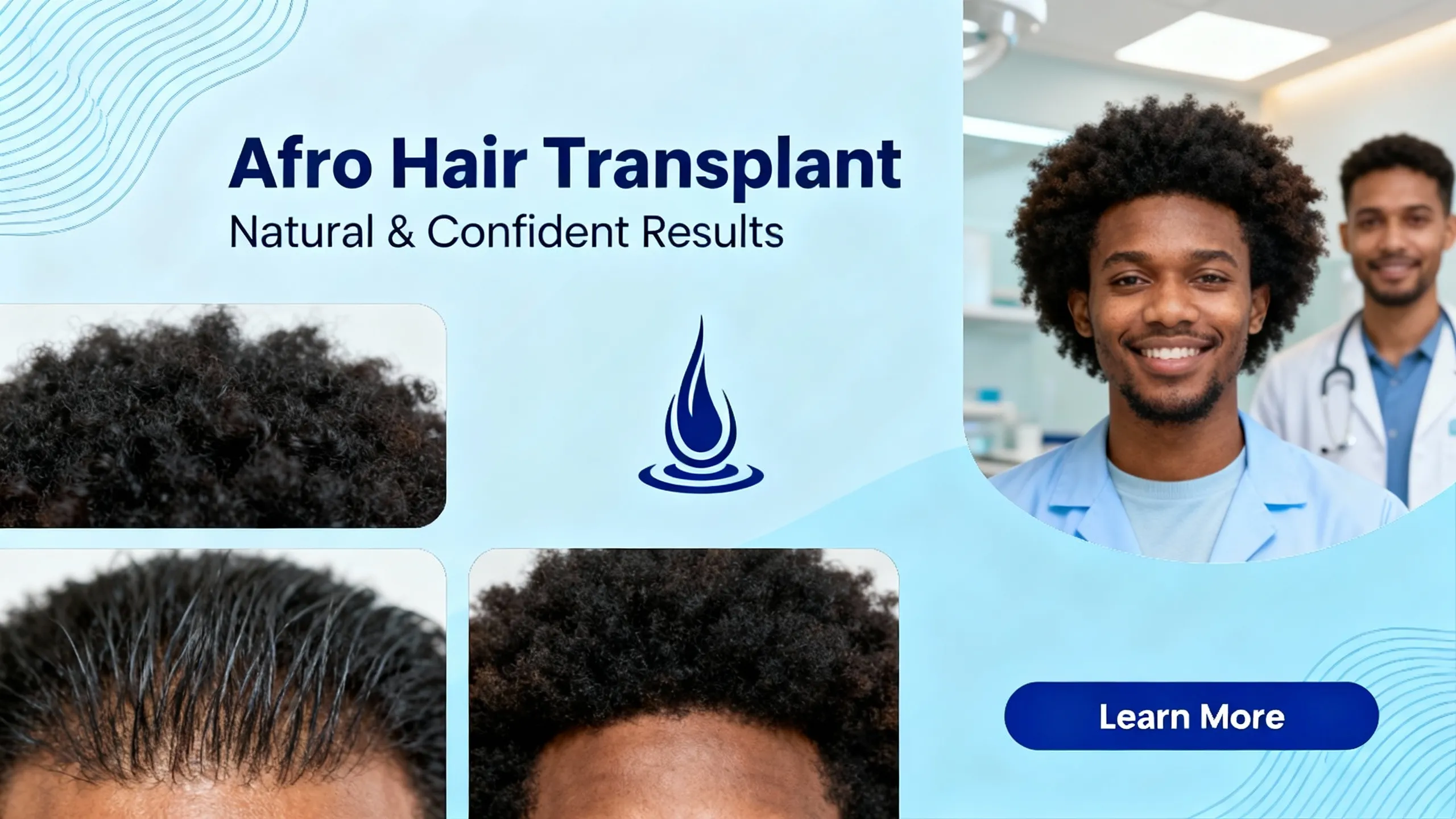 Afro Hair Transplant (2) Afro Hair Transplantation Guide
