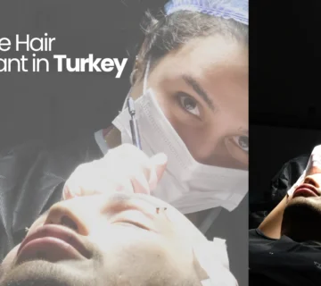 Sapphire Hair Transplant