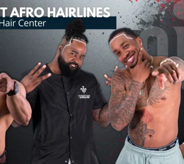 Transform Your Future With Afro Hair Transplant In Turkey