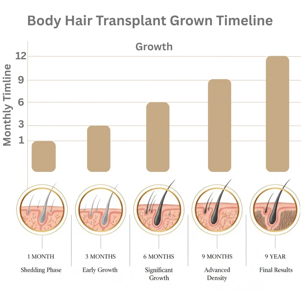 Body Hair Transplant 10 Body Hair Transplant Growth Timeline