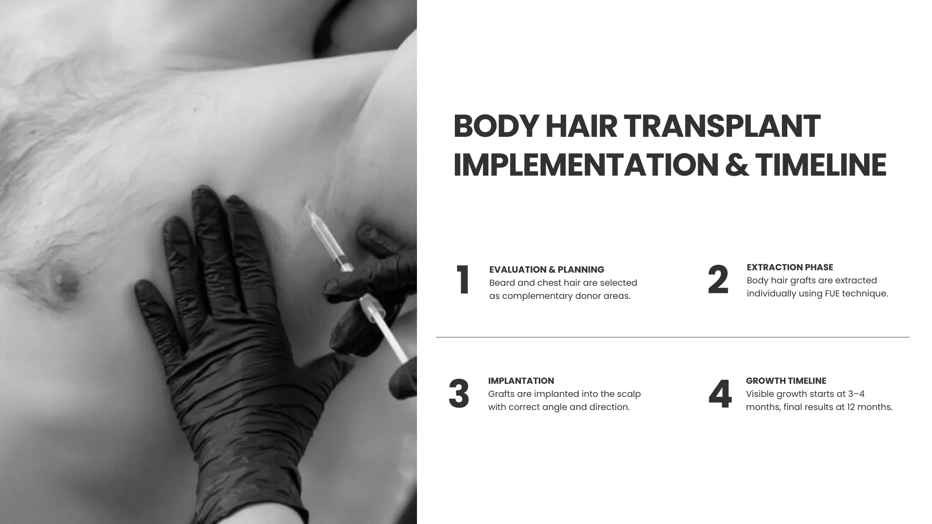 Body Hair Transplant 9 Body Hair Transplant Timeline