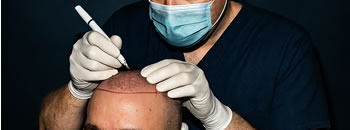 Dhi Hair Transplant