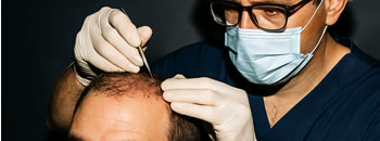No Shave Hair Transplant