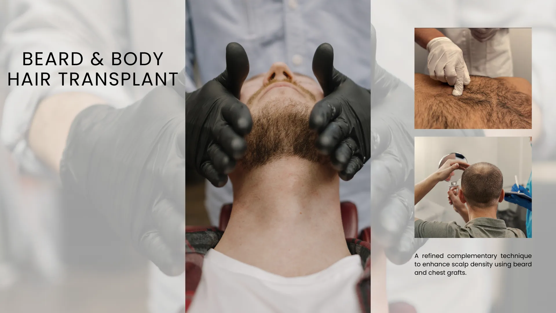 Body Hair Transplant 6 What Is Body Hair Transplant