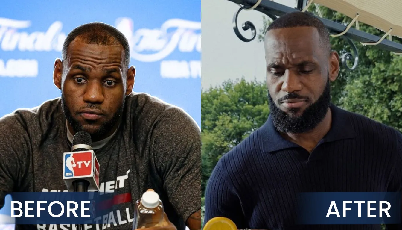 Lebron-James-Hair-Transplant-Real-Life-Before-After Real Life Public Appearance Before And After Hair Transplant Comparison Of Lebron James