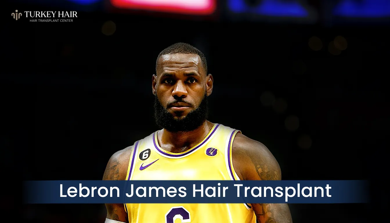 Lebron-James-Hair-Transplant. Lebron James Hair Transplant Before And After Transformation Cover Image