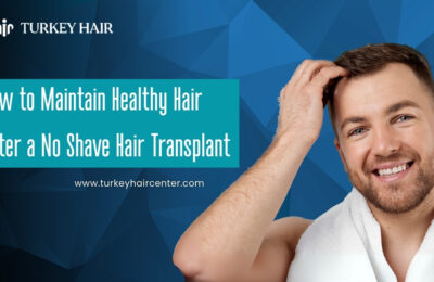 No Shave Hair Transplant