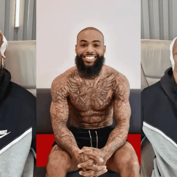 After Afro Hair Transplant