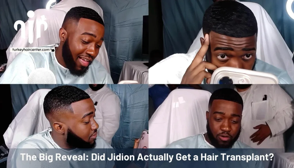 Jidion Adams Hairline