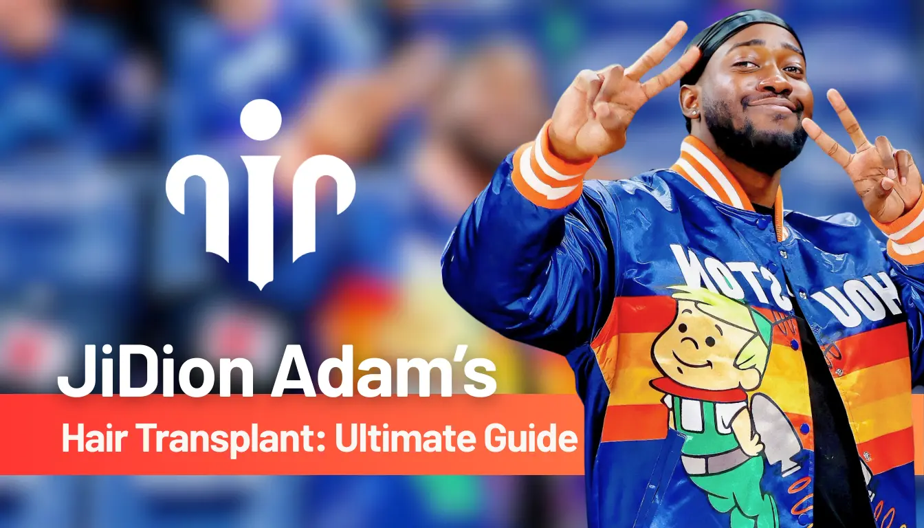 Jidion Hair Transplant The Ultimate Guide