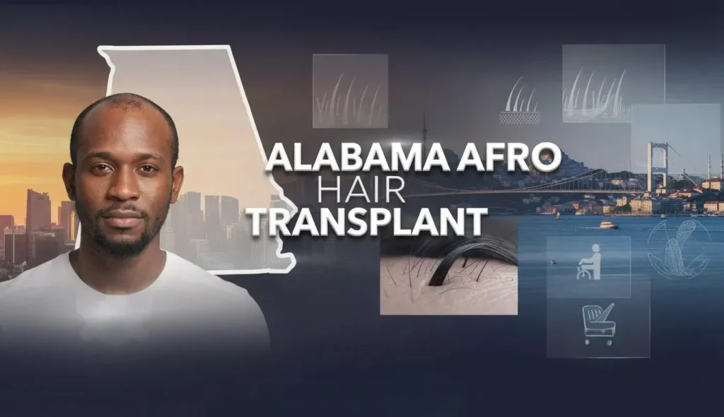 Alabama Afro Hair Transplant