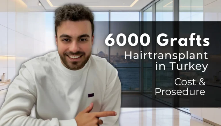 6000 Grafts Hair Transplant Turkey - Cost And Procedure 6 6000 Grafts Hair Transplant Turkey
