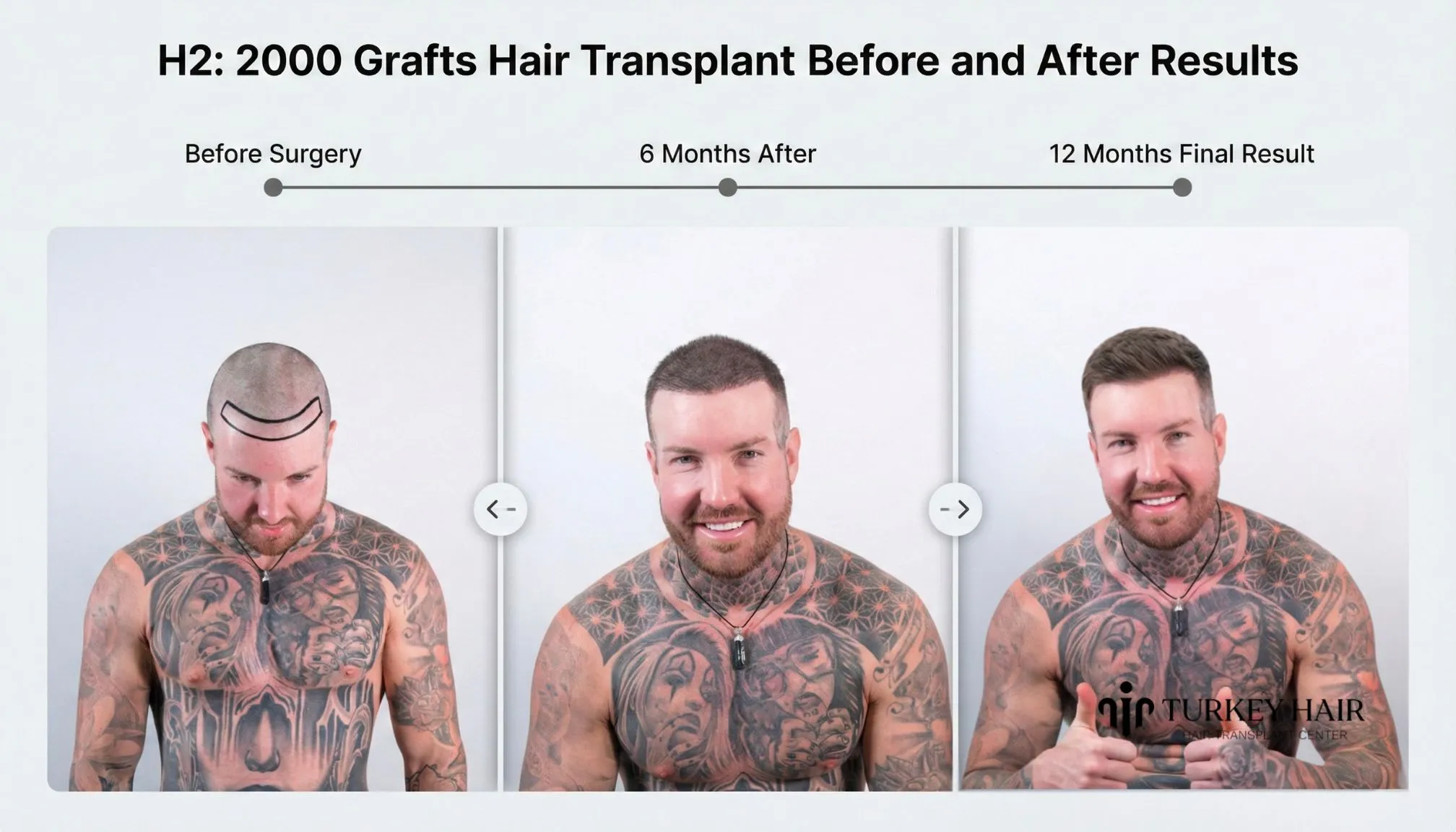 Before And After Result