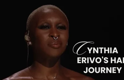 Cynthia Erivo Hair Transplant Journey