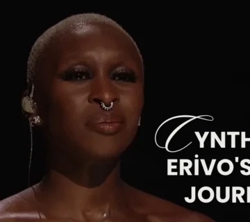 Cynthia Erivo Hair Transplant Journey