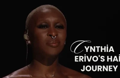 Cynthia Erivo Hair Transplant Journey