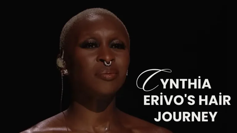 Cynthia Erivo Hair Transplant Journey 1 Cynthia Erivo Hair Transplant Journey