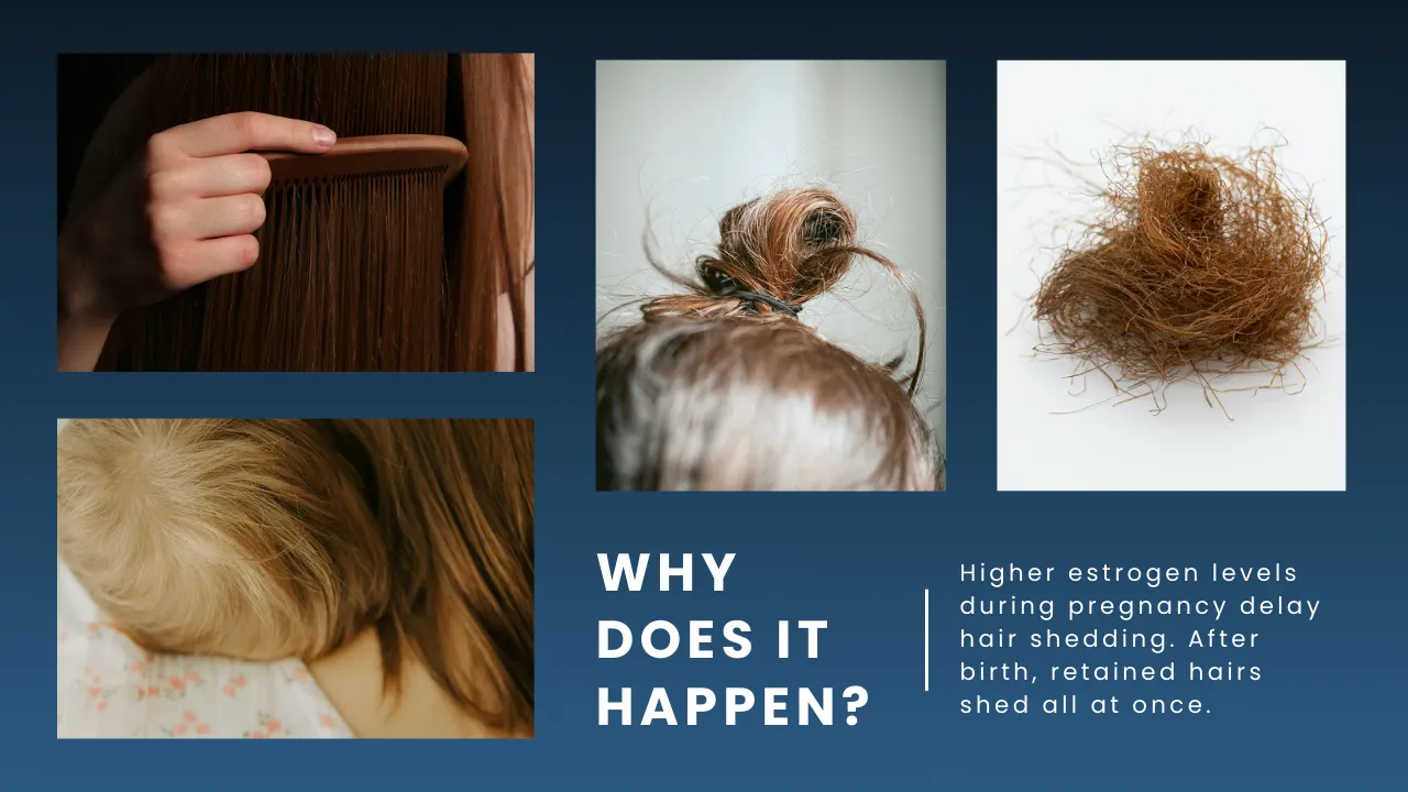 Postpartum Hair Loss Guide: Causes, Recovery And Healthy Regrowth 4 Hormonal Changes And Their Role In Postpartum Hair Loss