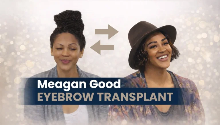 Meagan Good Eyebrow Transplant