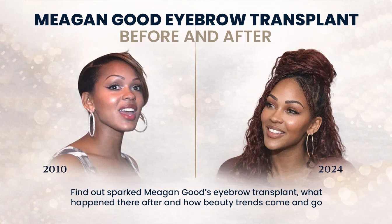 Meagan Good Eyebrow Transplant Before And After Comparison