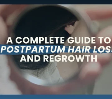 Postpartum Hair Loss Guide Causes, Recovery And Healthy Regrowth