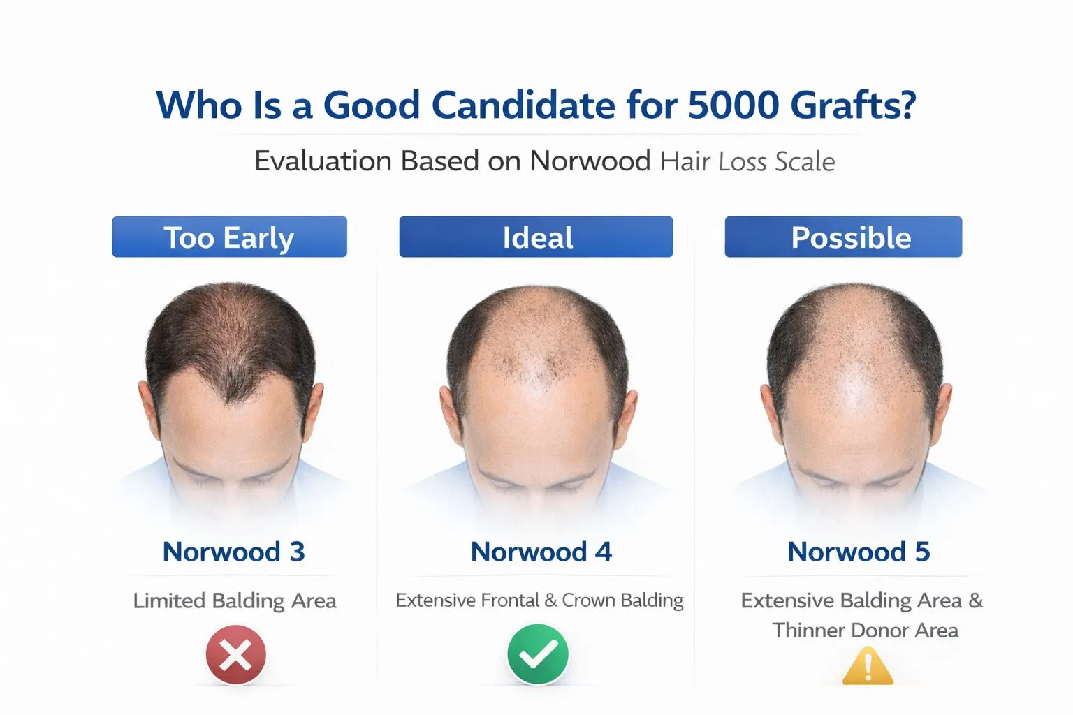 Who Is An Ideal Candidate For 5000 Grafts Ai Generated Illustration Not Real Patient Result