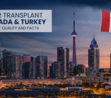 Hair Transplant Canada Vs Turkey