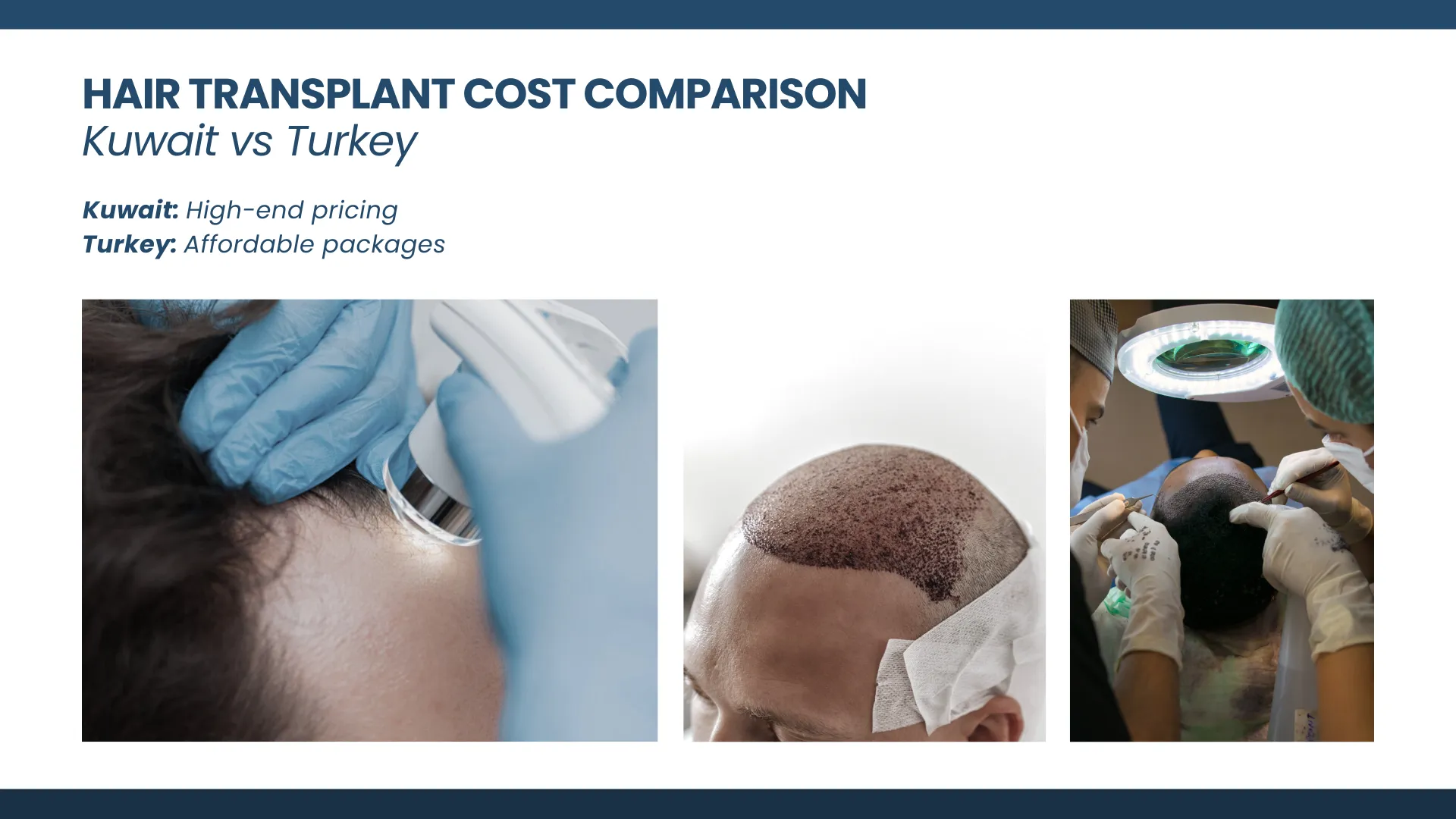 Hair Transplant Costs In Turkey