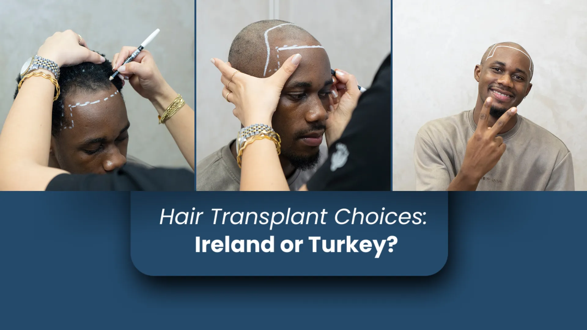 Making The Right Choice Ireland Or Turkey