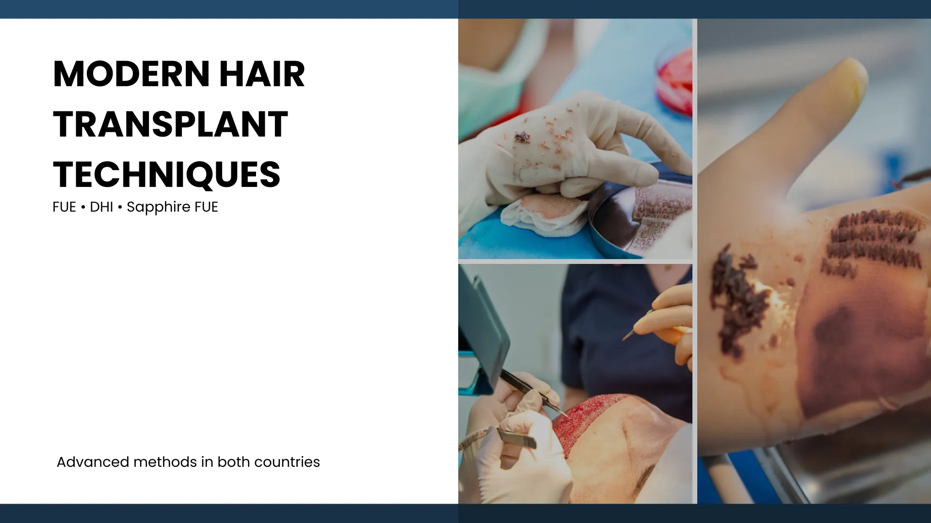 Surgical Techniques As The Foundation Of Procedures In Both Countries