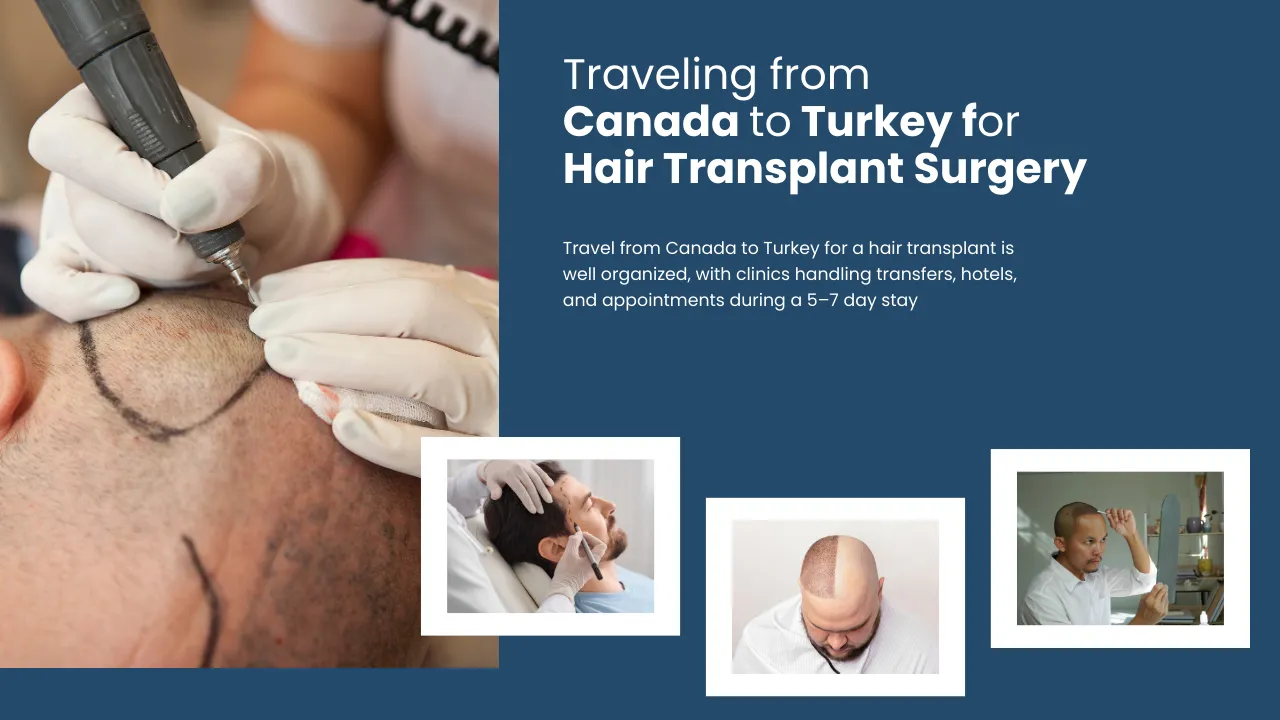 Traveling From Canada To Turkey For Hair Transplant Surgery 