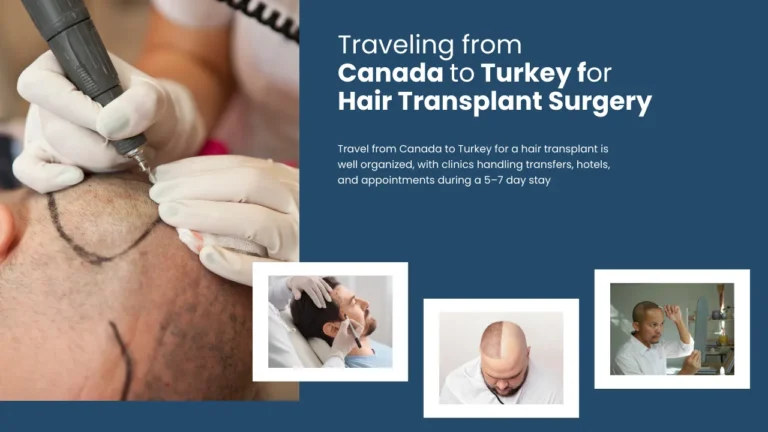 Traveling-From-Canada-To-Turkey-For-Hair-Transplant-Surgery--768X432 Hair Transplant Canada Vs Turkey Cost And Care Analysis Hair Restoration Excellence You Can Trust