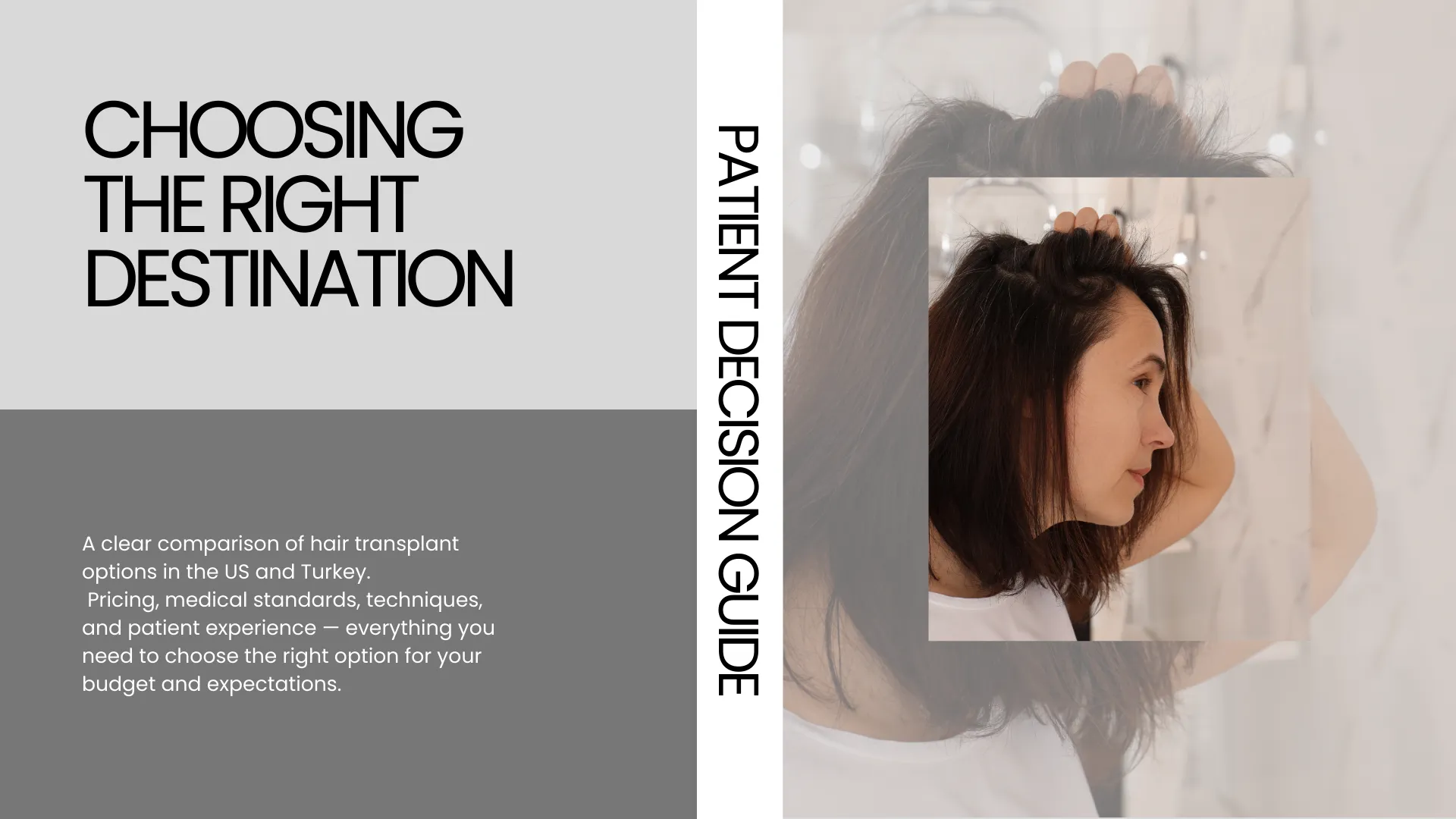 Traveling To Usa Vs Turkey For Hair Transplant