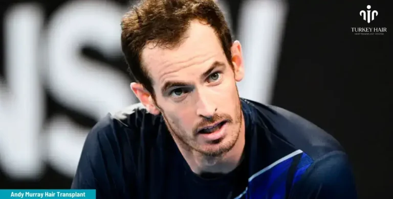 Andy-Murray-Hair-Transplant-3-1-768X390 Britain’s Number 1 Tennis Player Andy Murray’s Hair Transplant