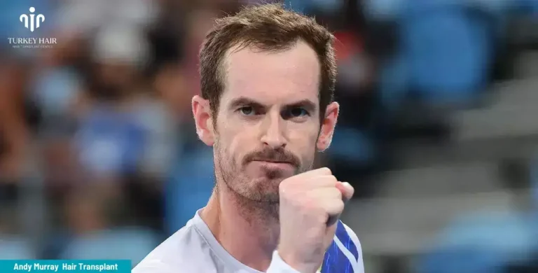 Andy-Murray-Hair-Transplant-6-1-768X390 Britain’s Number 1 Tennis Player Andy Murray’s Hair Transplant