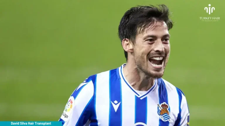 David-Silva-Hair-Transplant-1-768X432 Discover David Silva Hair Transplant 2026