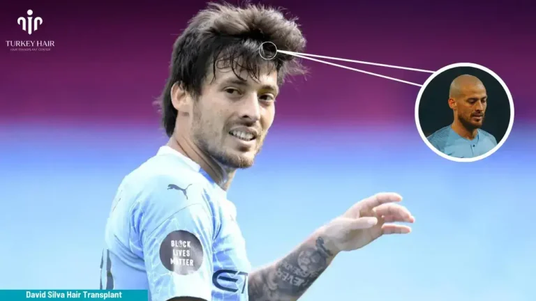 David-Silva-Hair-Transplant-2-768X432 Discover David Silva Hair Transplant 2026