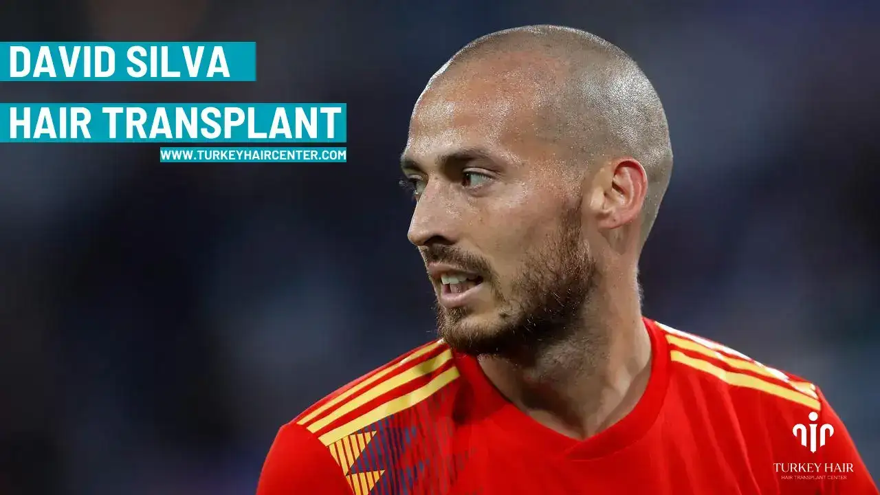 Discover David Silva Hair Transplant 2026