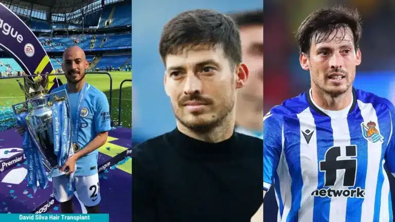David-Silva-Hair-Transplant-6-768X432 Discover David Silva Hair Transplant 2026