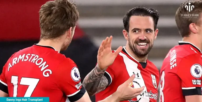 Danny-Ings-Hair-Transplant-17-768X390 Let’s Discover Succesfull Striker Danny Ings’ Hair Transplant 2026