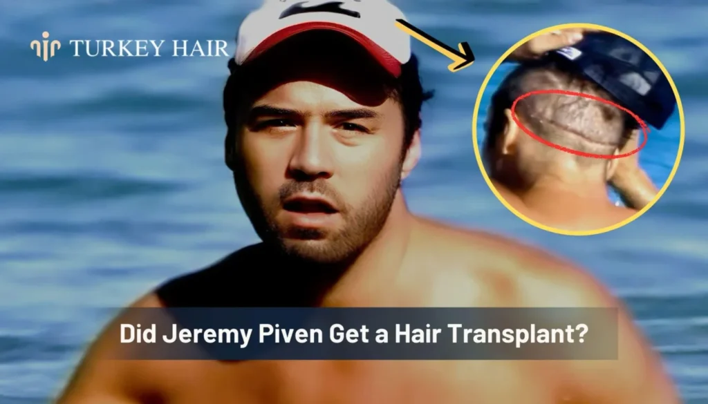 Did-Jeremy-Piven-Get-A-Hair-Transplant-1344X768 Jeremy Piven Hair Transplant – Before And After