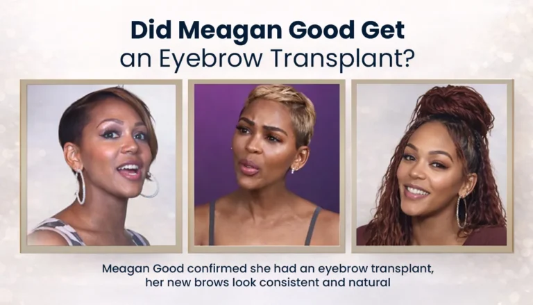 Did-Meagan-Good-Get-An-Eyebrow-Transplant-768X439 Meagan Good Eyebrow Transplant Before And After
