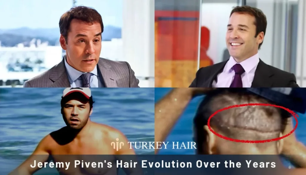 Jeremy-Pivens-Hair-Evolution-Over-The-Years-1344X768 Jeremy Piven Hair Transplant – Before And After